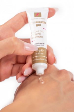 Scar treatment